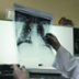 Пандемия осложнила лечение патологий органов дыхания