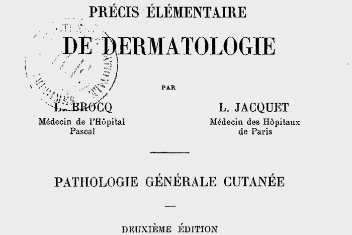 Болезнь женщин, живущих в мегаполисах