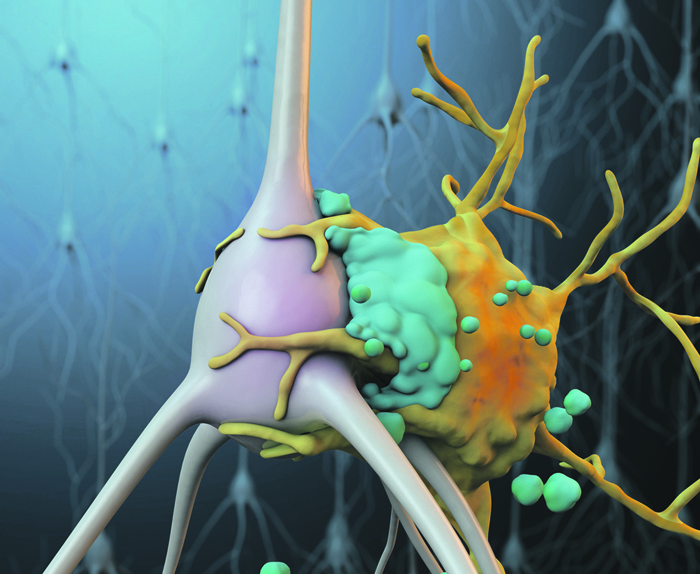 Как защитить нейроны от бляшек Альцгеймера