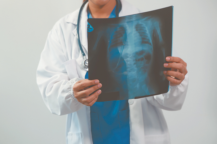 Как искусственный интеллект меняет здравоохранение 