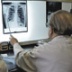 Россия как образец борьбы с туберкулезом