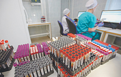 О чем может рассказать клинический анализ крови