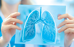 Как эмфизема легких стала болезнью мужского рода